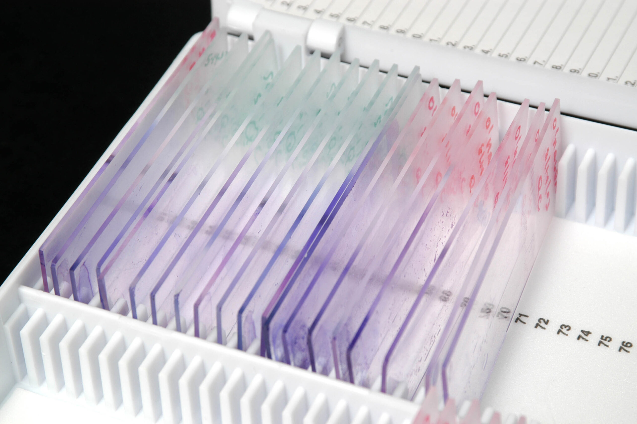 Close-up of specimen slides stored in a specimen slide case