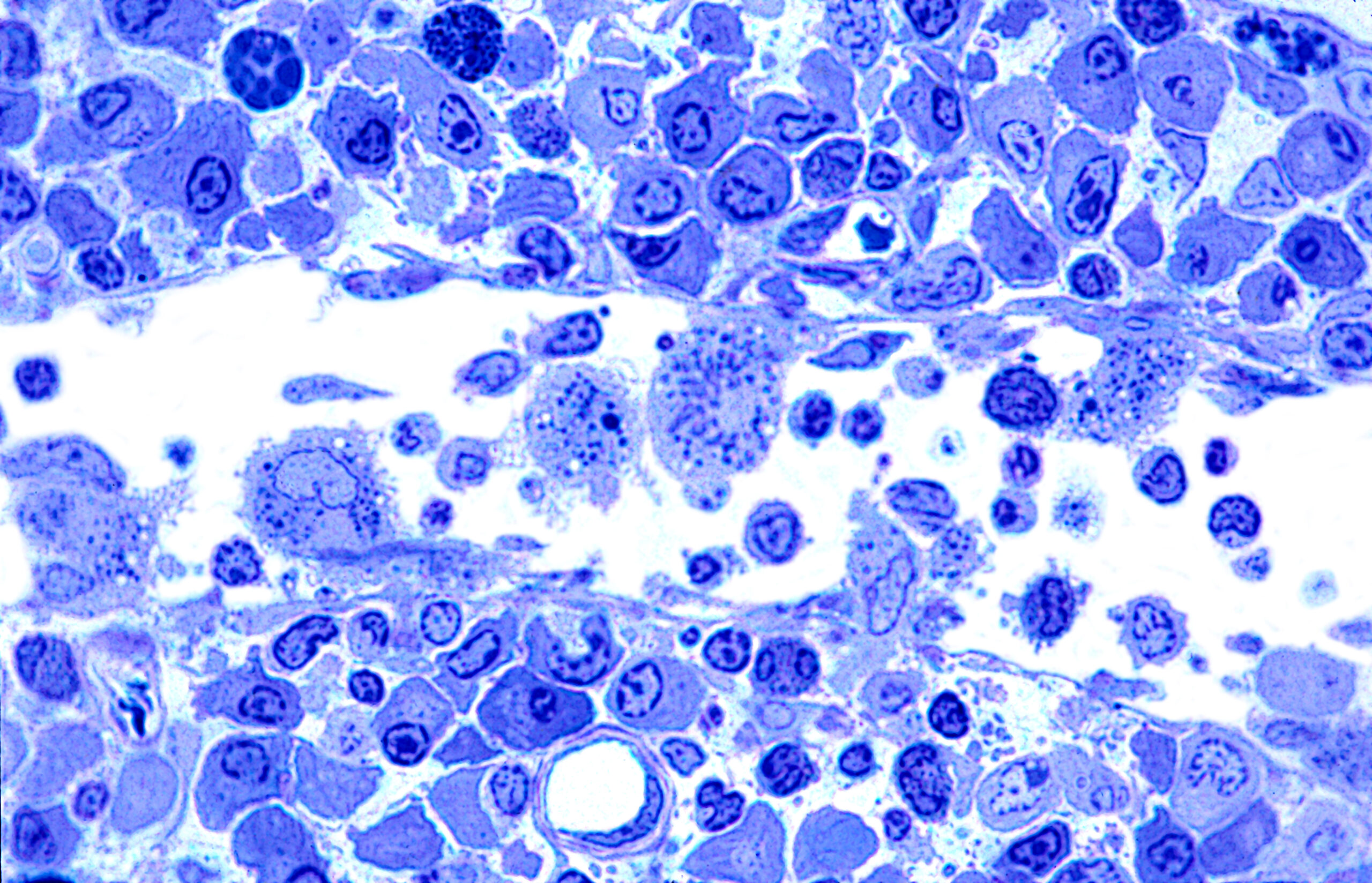 Microscopic image of a histological slide showing lymph node tissue