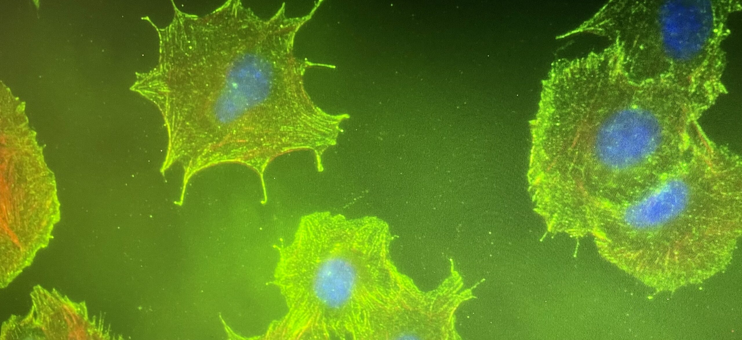 Microscopic image of fluorescently stained fibroblasts