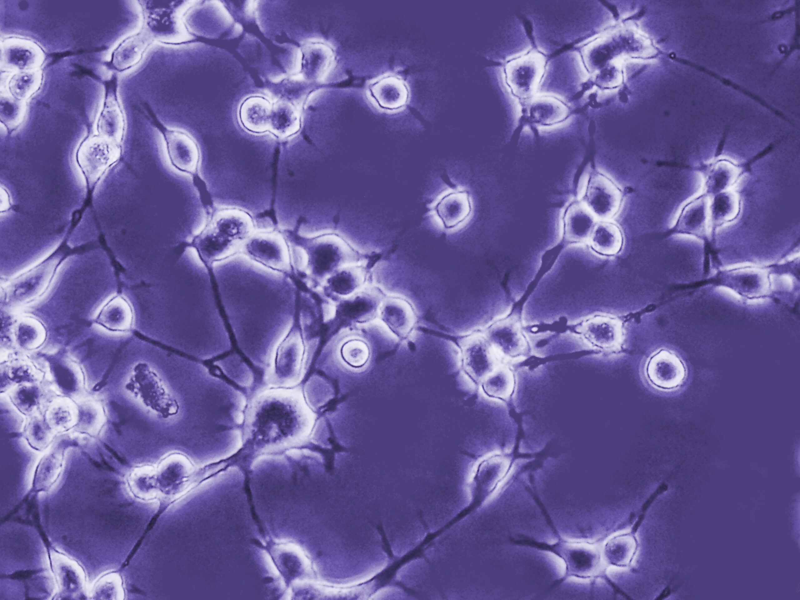 Phase contrast image of neurons in cell culture