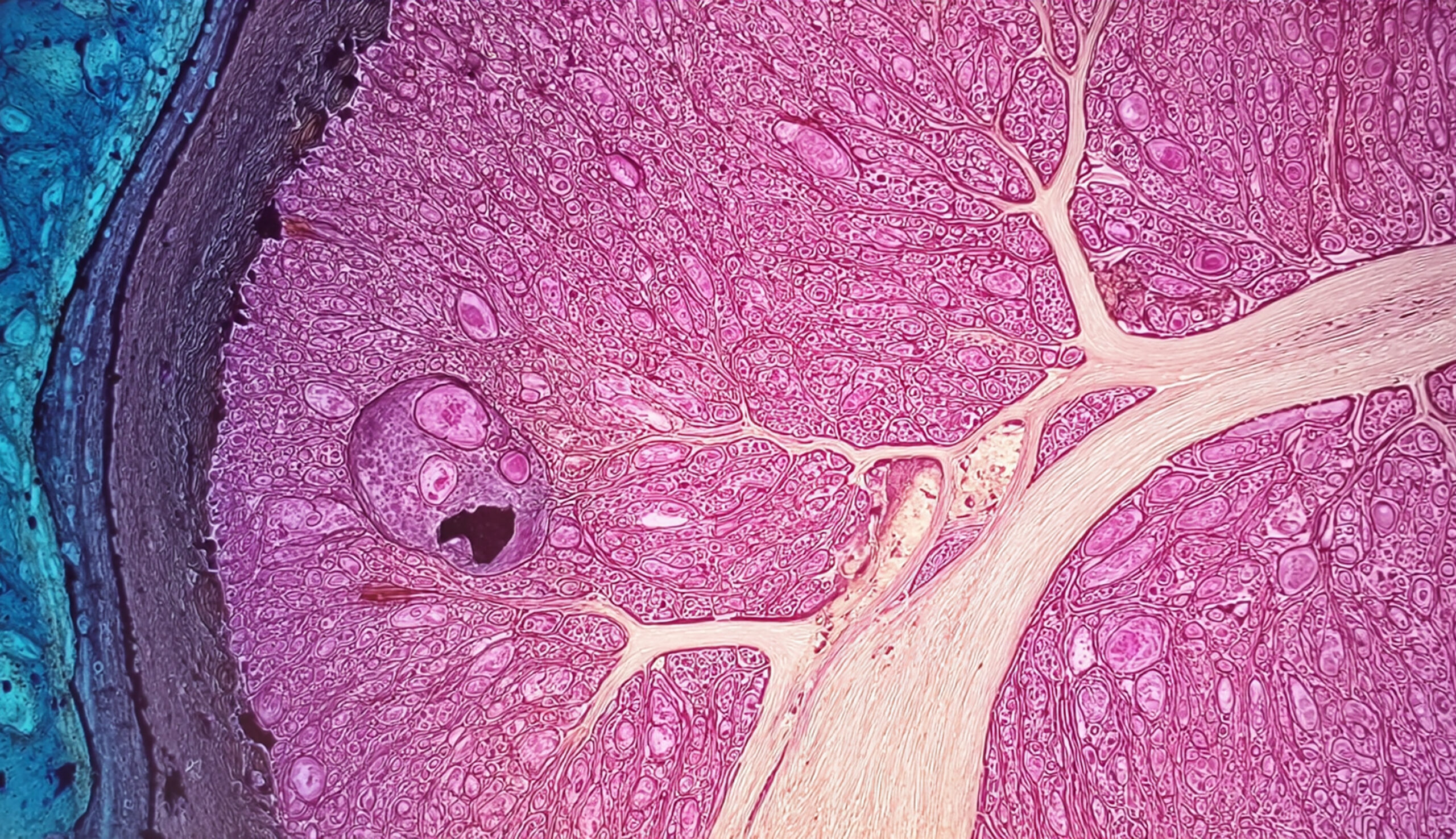 Microscopic image of a stained histological tissue section, likely a kidney