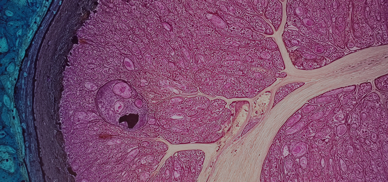 Microscopic image of a stained histological tissue section, likely a kidney