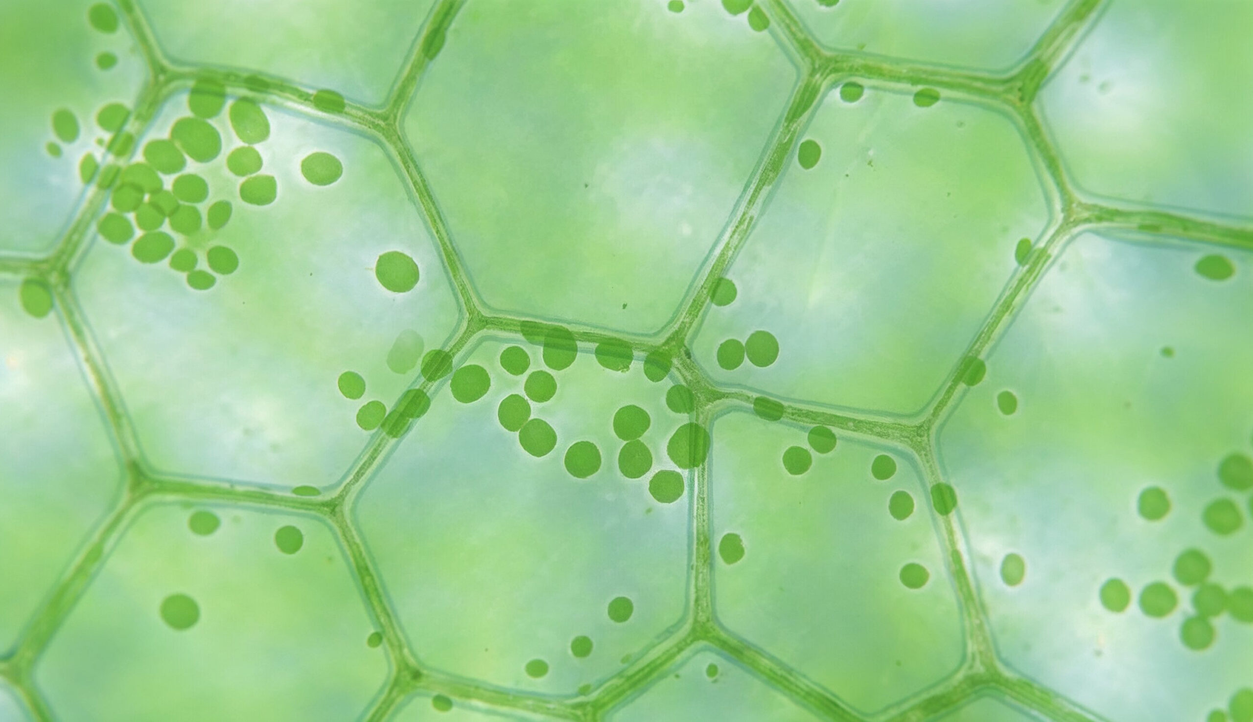 Microscope image of green plant cells with chloroplasts