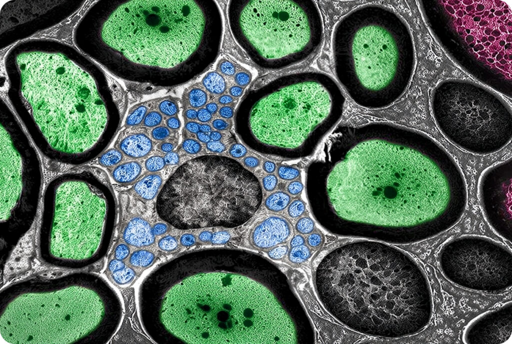 Pharmaceutical competitive intelligence: Seeing key signals before others do