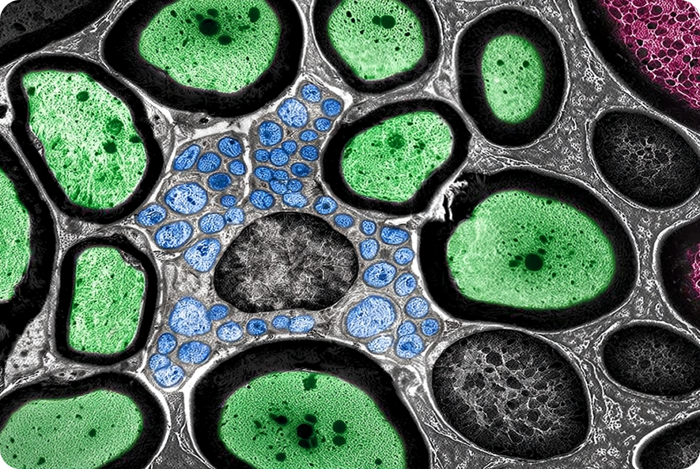 Microscopic cross-section of a nerve bundle